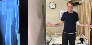Tony Hawk Terancam Tidak Bisa Meluncur Di Papan Skate Lagi Tony Hawk Terancam Tidak Bisa Meluncur Di Papan Skate Lagi