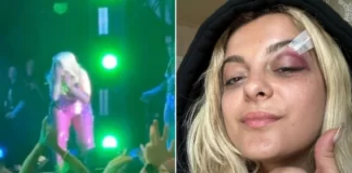 Bebe Rexha Jatuh Berlutut Dilempar Handphone Fans Bebe Rexha membagikan video kabar terbarunya dengan penggemar ke TikTok di mana dia menunjukkan matanya yang sakit tetapi meyakinkan penggemar, "Aku baik-baik saja, kalian."
